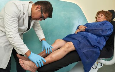 Does Medicare pay for varicose vein treatment